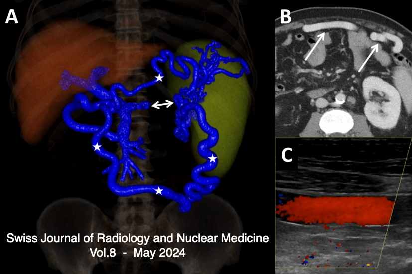 					View Vol. 8 No. 1 (2024): Liver disease & Ovarian Goitre
				