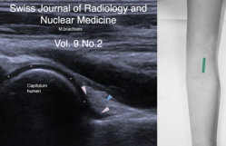 					View Vol. 9 No. 2 (2024): Ultrasound Analysis of the Most Important Musculoskeletal Issues
				