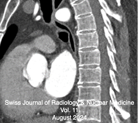 					View Vol. 11 No. 1 (2024): Mediastinal Distortions & Archimedes Leverage of Research Funding
				