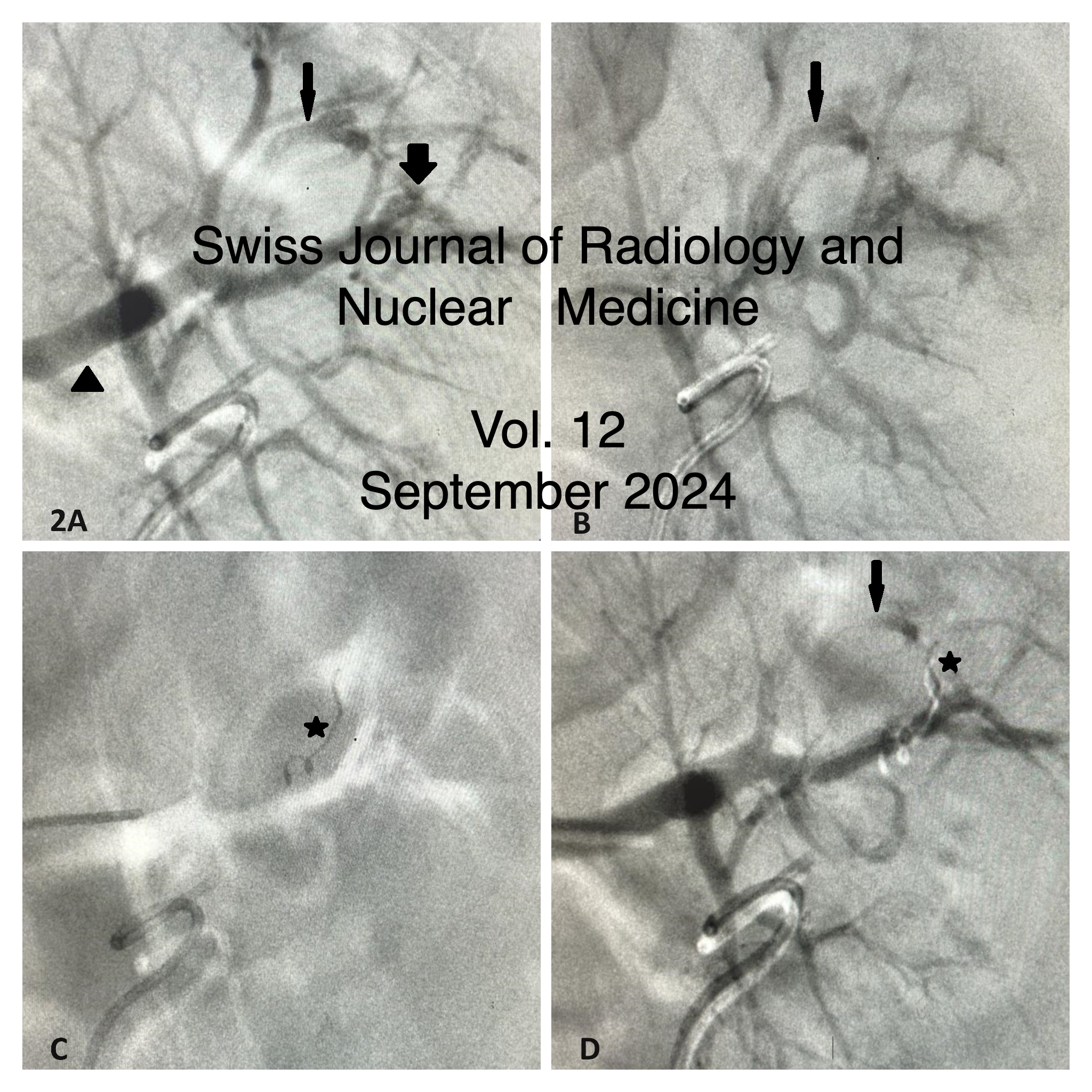 					View Vol. 12 No. 1 (2024): Synchronous endovascular management of post PCNL concurrent pseudoaneurysm and AV fistula & Automatic Joint Teeth Segmentation in Panoramic Dental Images using Mask Recurrent Convolutional Neural Networks with Residual Feature Extraction: Can it be useful in Oral Cancer Diagnosis and Management?
				