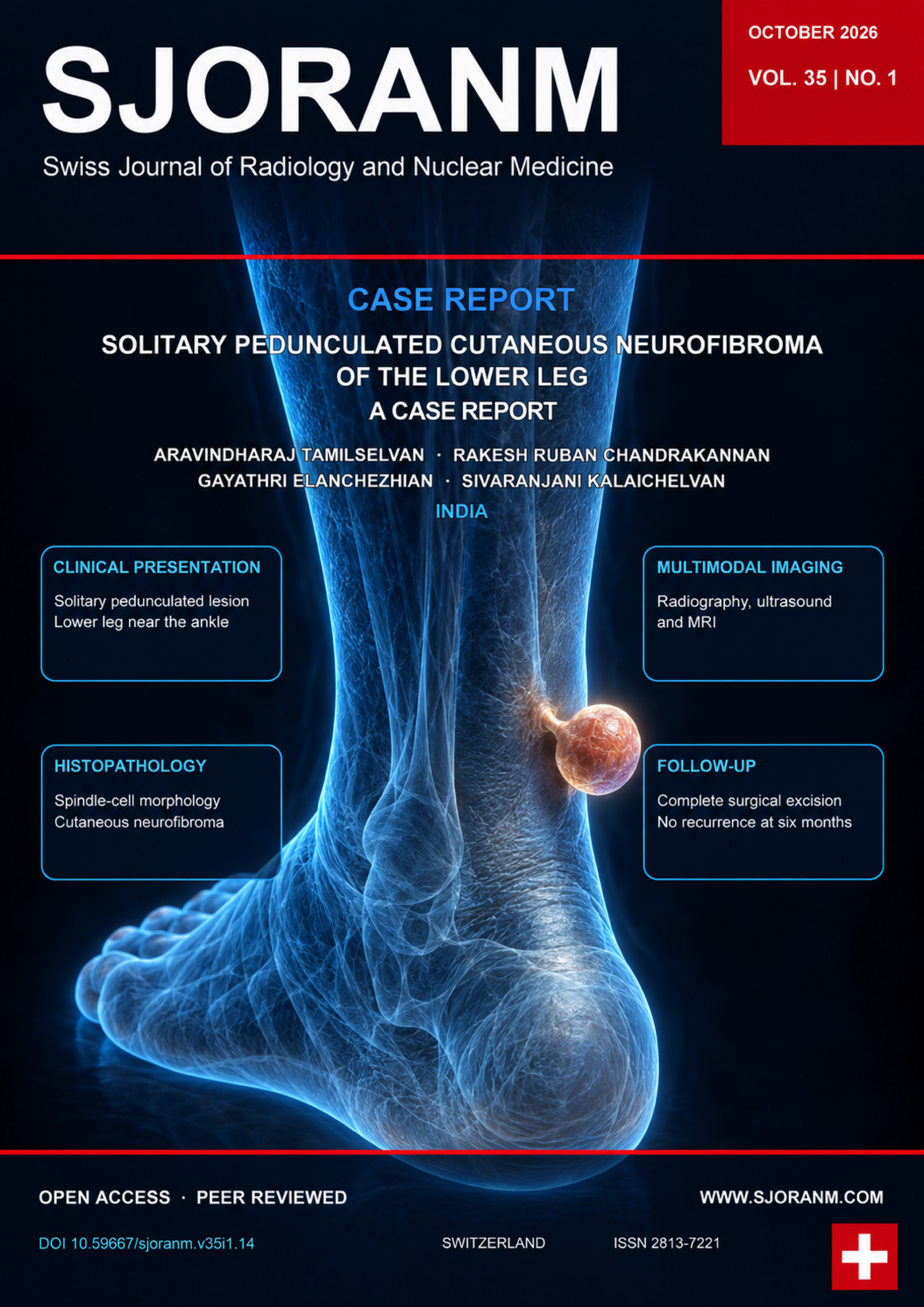 SJORANM October 2026, Vol. 35 No. 1: holographic illustration of a solitary pedunculated cutaneous neurofibroma of the lower leg.