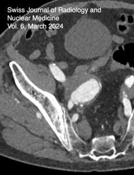 					View Vol. 6 No. 1 (2024): Endovascular Intervention
				