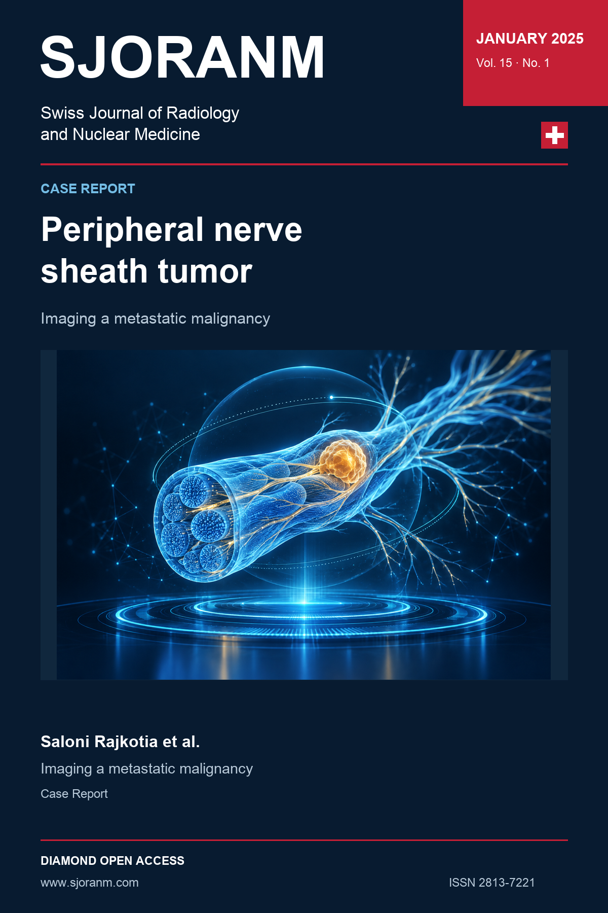 SJORANM article cover: Peripheral nerve sheath tumor. Vol. 15 No. 1, January 2025. Holographic symbolic illustration.